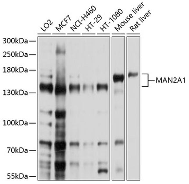 MAN2A1 Antibody in Western Blot (WB)