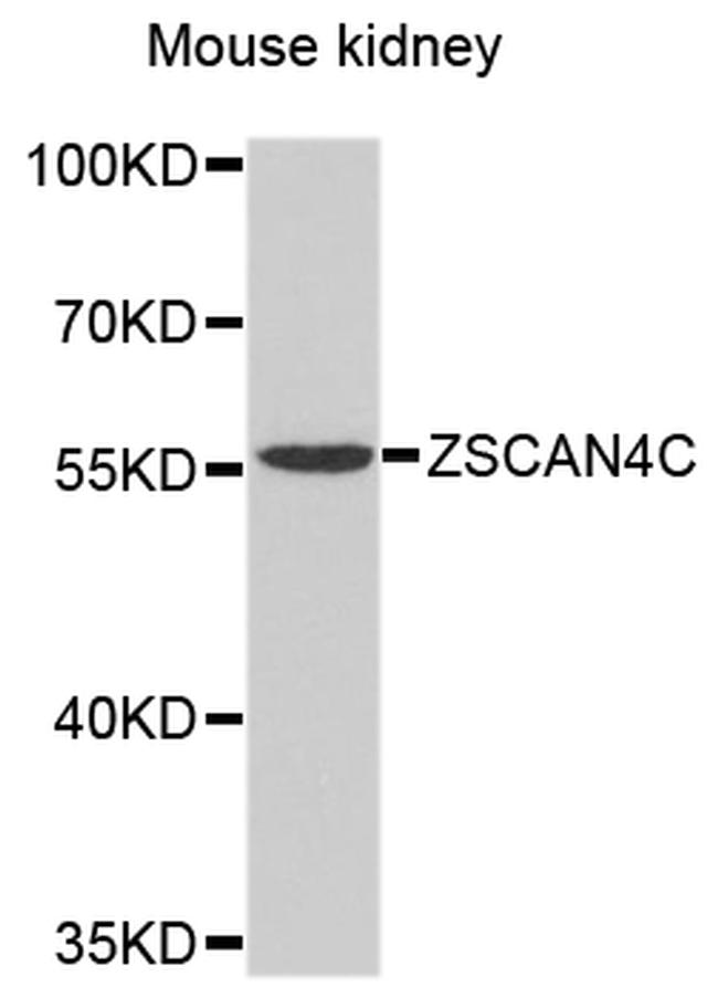 ZSCAN4C Antibody in Western Blot (WB)