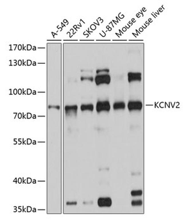 KCNV2 Antibody in Western Blot (WB)