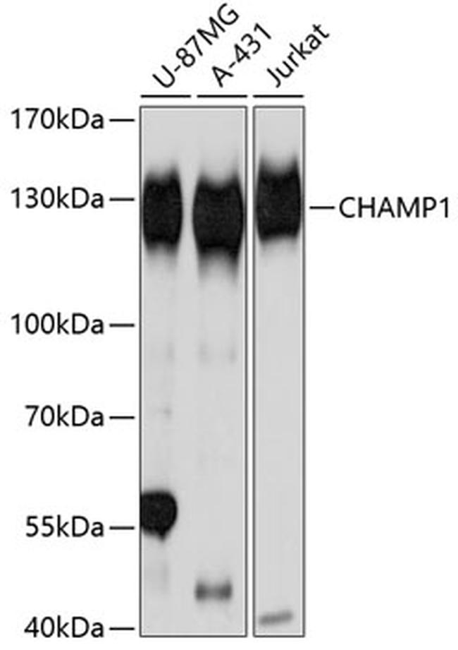 CHAMP1 Antibody in Western Blot (WB)