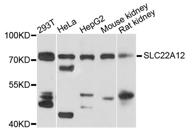 SLC22A12 Antibody in Western Blot (WB)