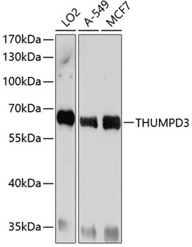 THUMPD3 Antibody in Western Blot (WB)