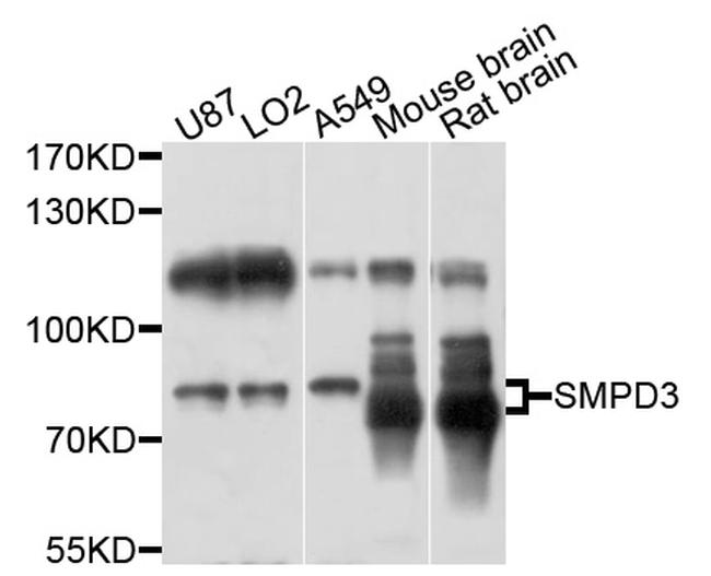 SMPD3 Antibody in Western Blot (WB)