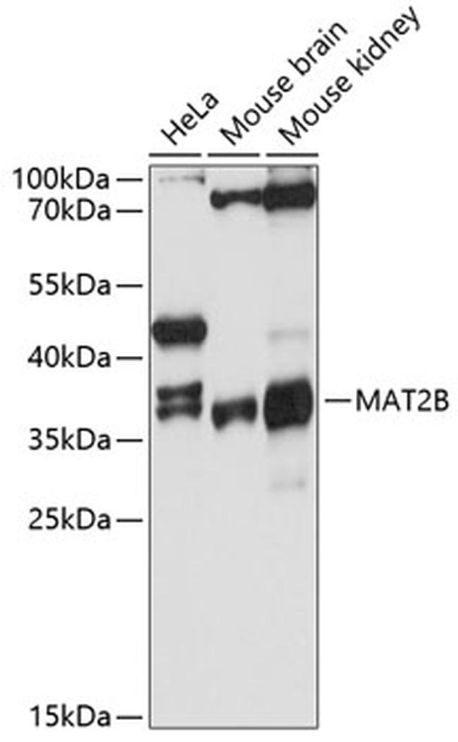 MAT2B Antibody in Western Blot (WB)