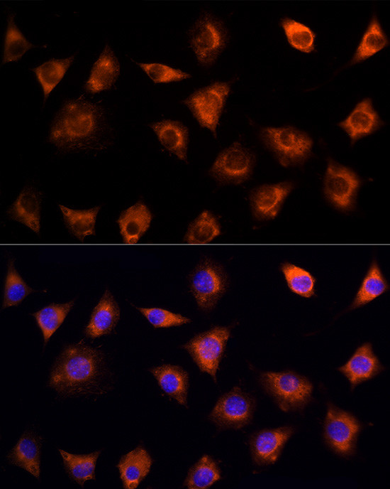 IL17C Antibody in Immunocytochemistry (ICC/IF)