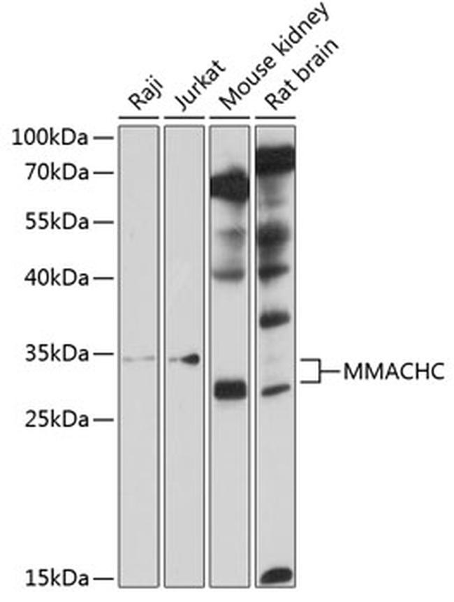 MMACHC Antibody in Western Blot (WB)