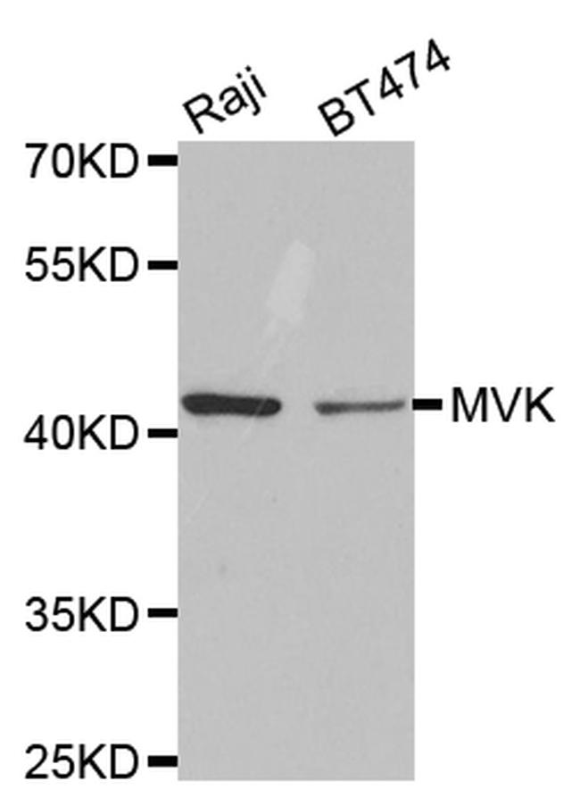 MVK Antibody in Western Blot (WB)