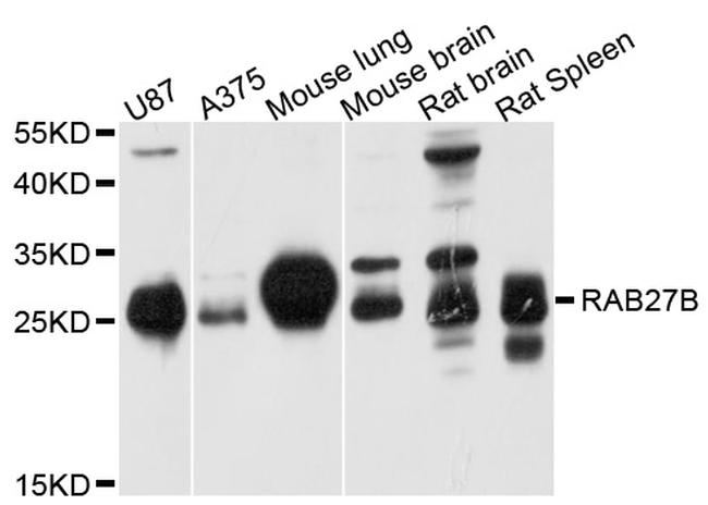 RAB27B Antibody in Western Blot (WB)