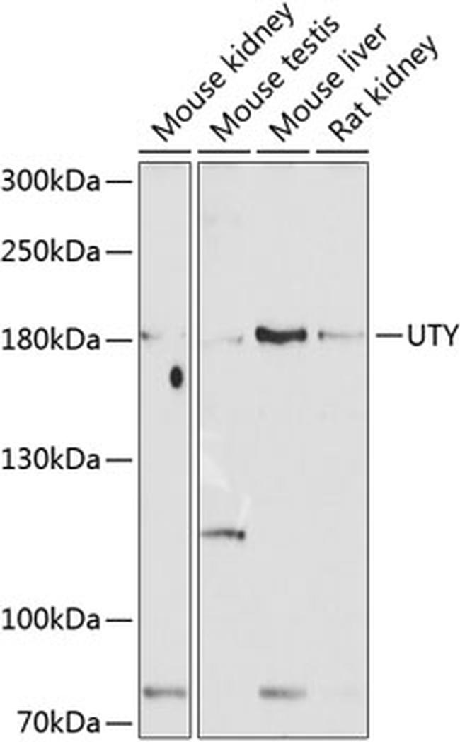 UTY Antibody in Western Blot (WB)