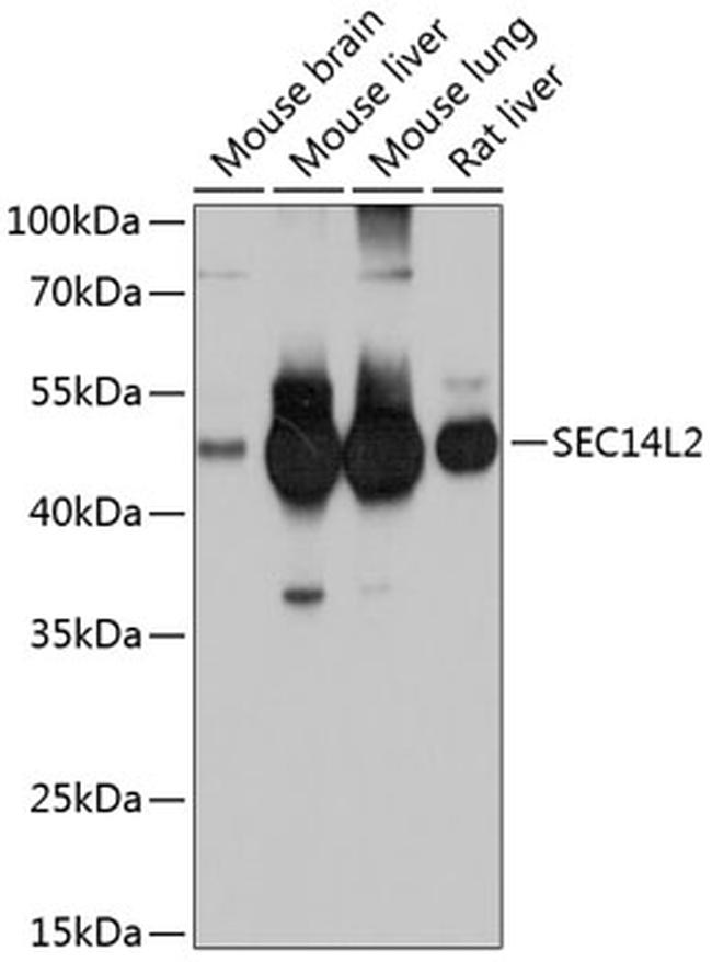 SEC14L2 Antibody in Western Blot (WB)