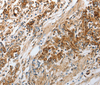 NPY1R Antibody in Immunohistochemistry (Paraffin) (IHC (P))