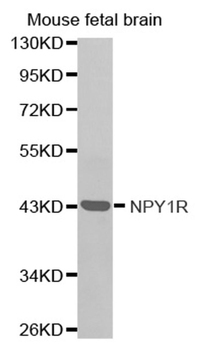 NPY1R Antibody in Western Blot (WB)