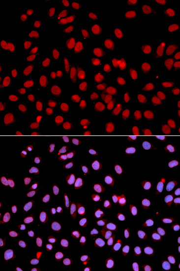 POLR2J Antibody in Immunocytochemistry (ICC/IF)