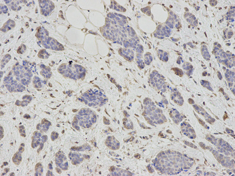 PSMC6 Antibody in Immunohistochemistry (Paraffin) (IHC (P))