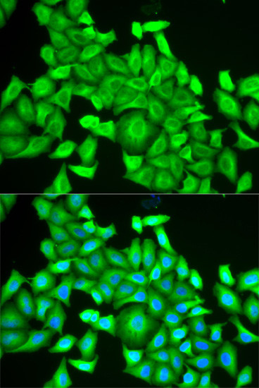 RAB6A Antibody in Immunocytochemistry (ICC/IF)