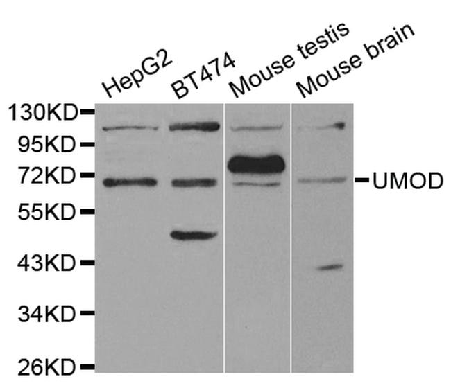 Uromodulin Antibody in Western Blot (WB)