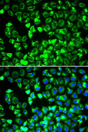 DLD Antibody in Immunocytochemistry (ICC/IF)