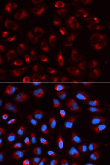 DLD Antibody in Immunocytochemistry (ICC/IF)