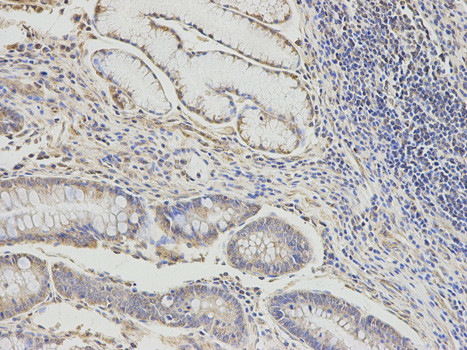 DLD Antibody in Immunohistochemistry (Paraffin) (IHC (P))