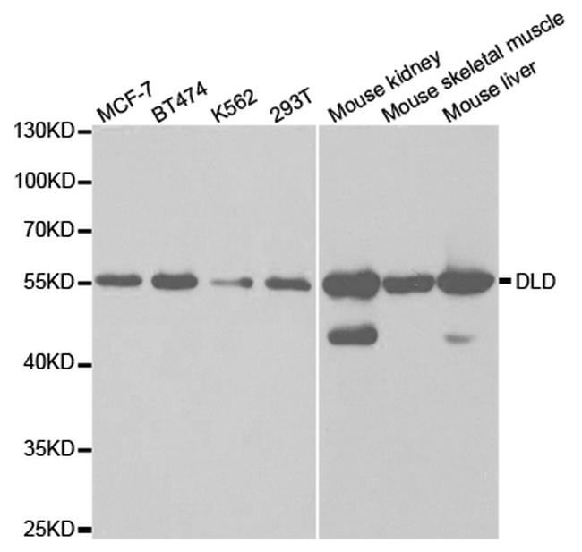 DLD Antibody in Western Blot (WB)