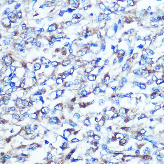 Optineurin Antibody in Immunohistochemistry (Paraffin) (IHC (P))