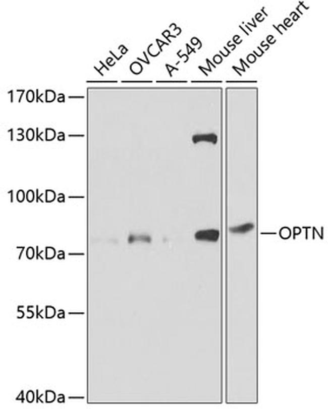 Optineurin Antibody in Western Blot (WB)