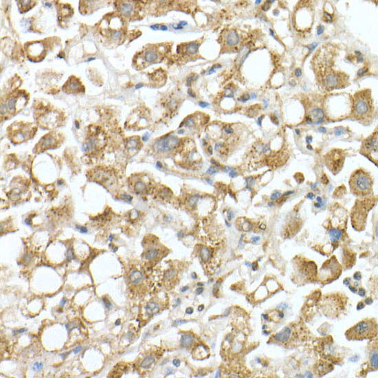 GLB1 Antibody in Immunohistochemistry (Paraffin) (IHC (P))