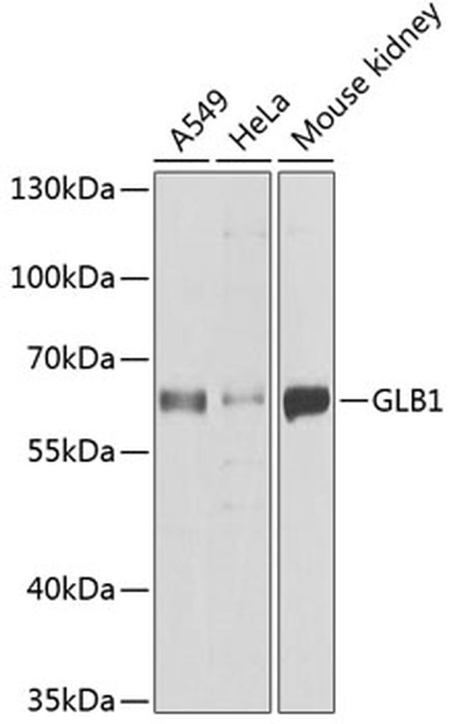 GLB1 Antibody in Western Blot (WB)