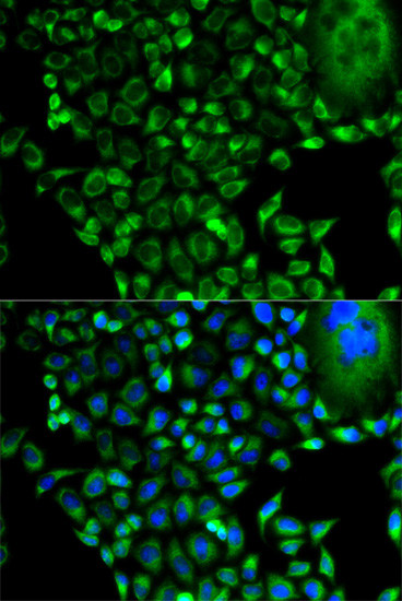 PSMD10 Antibody in Immunocytochemistry (ICC/IF)