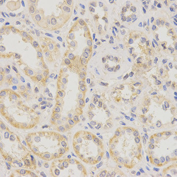 KCNN4 Antibody in Immunohistochemistry (Paraffin) (IHC (P))