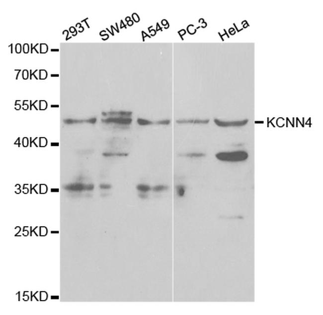 KCNN4 Antibody in Western Blot (WB)