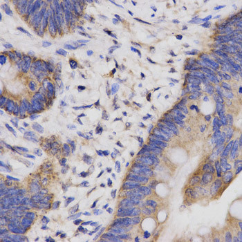 Cbl-b Antibody in Immunohistochemistry (Paraffin) (IHC (P))