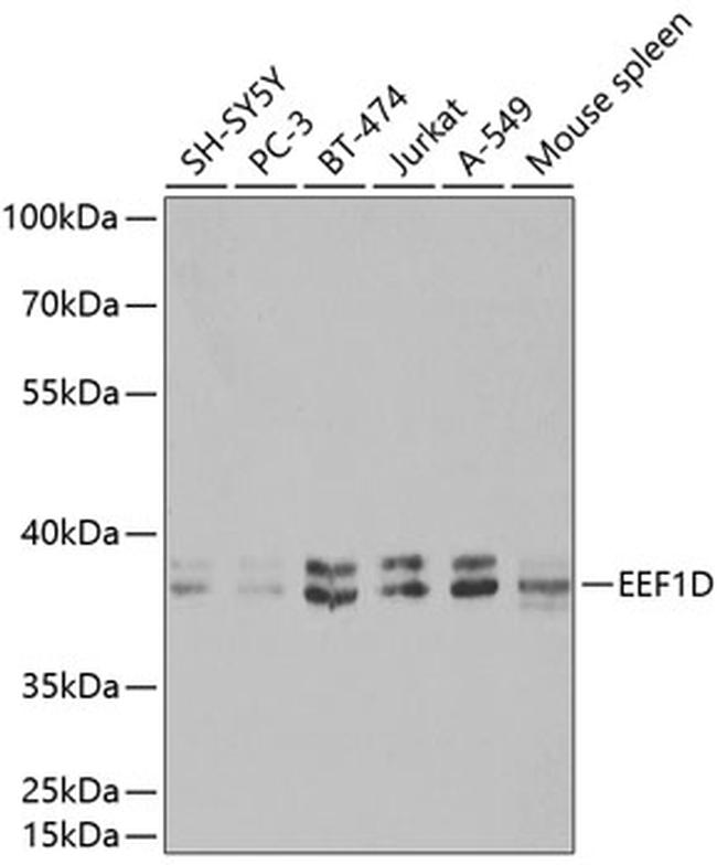 EEF1D Antibody in Western Blot (WB)