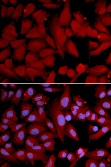 PSMA4 Antibody in Immunocytochemistry (ICC/IF)