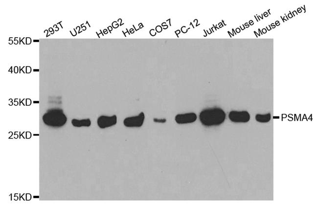 PSMA4 Antibody in Western Blot (WB)