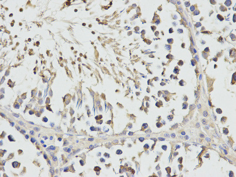 RPS3 Antibody in Immunohistochemistry (Paraffin) (IHC (P))