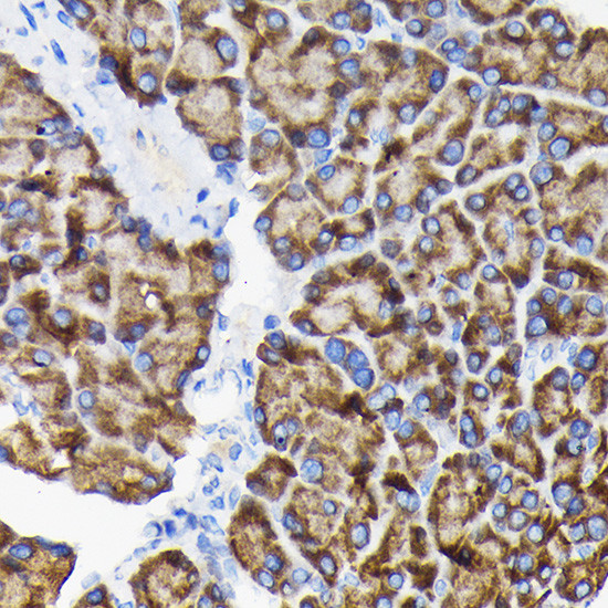 RPS3 Antibody in Immunohistochemistry (Paraffin) (IHC (P))