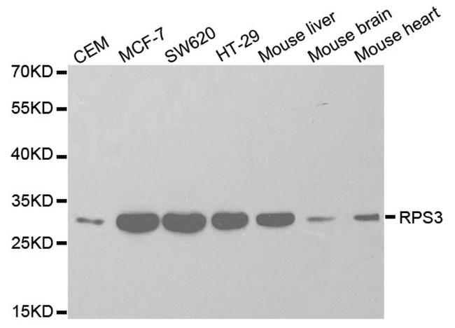 RPS3 Antibody in Western Blot (WB)