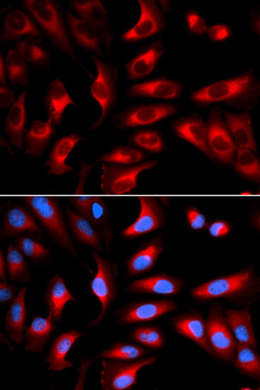 DNM1L Antibody in Immunocytochemistry (ICC/IF)