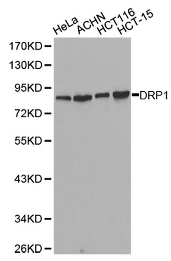 DNM1L Antibody in Western Blot (WB)