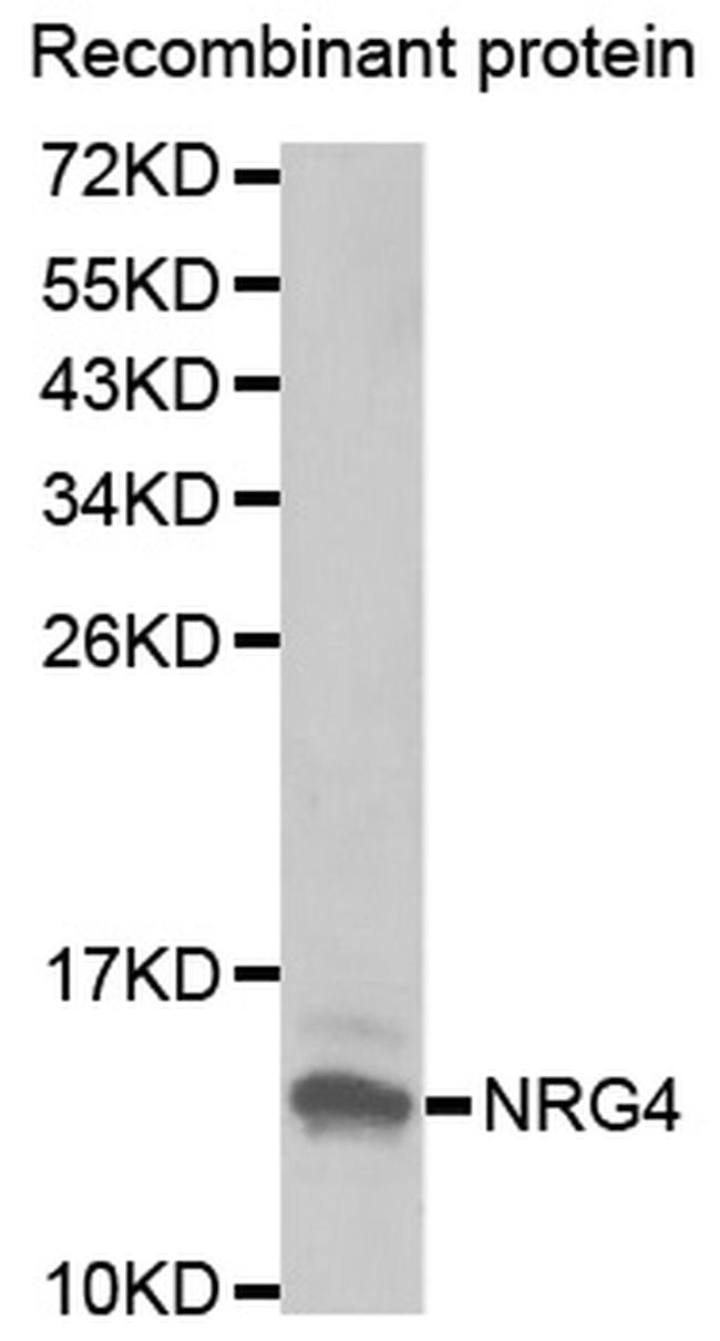 NRG4 Antibody in Western Blot (WB)