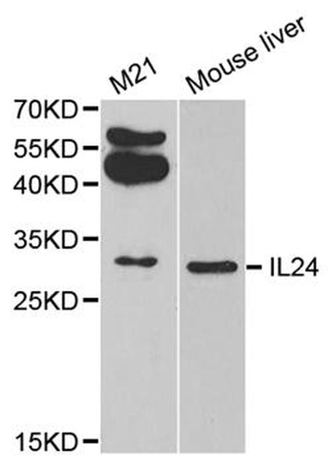 IL24 Antibody in Western Blot (WB)