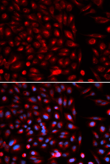 AXIN2 Antibody in Immunocytochemistry (ICC/IF)