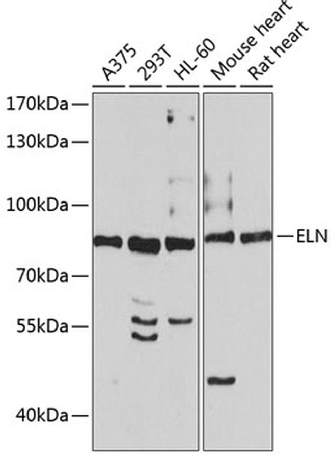 Elastin Antibody in Western Blot (WB)