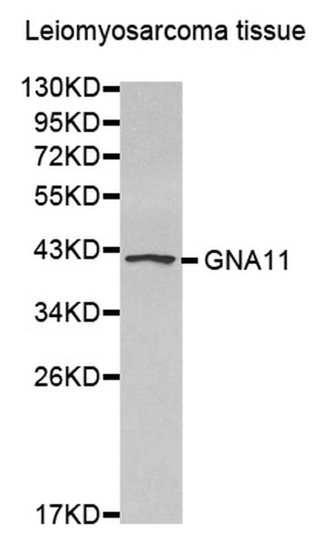 GNA11 Antibody in Western Blot (WB)