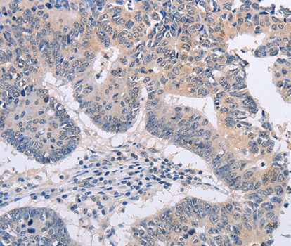 FBXO32 Antibody in Immunohistochemistry (Paraffin) (IHC (P))