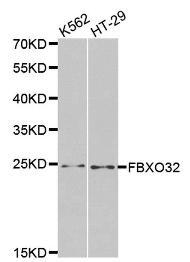 FBXO32 Antibody in Western Blot (WB)