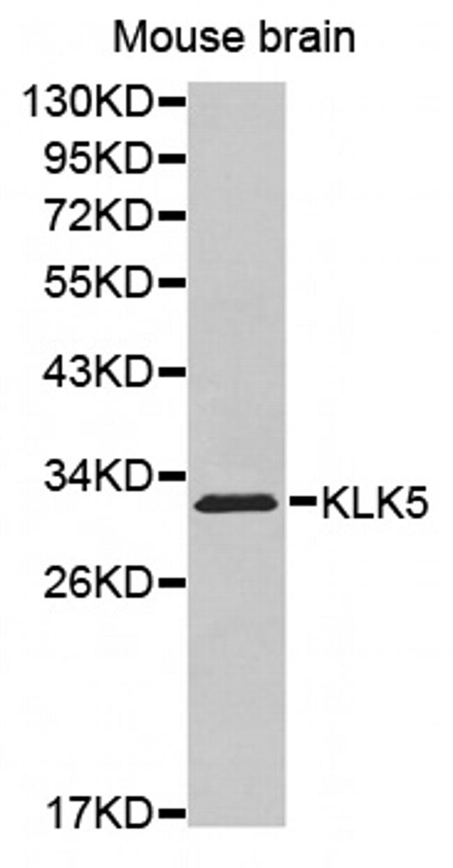 Kallikrein 5 Antibody in Western Blot (WB)