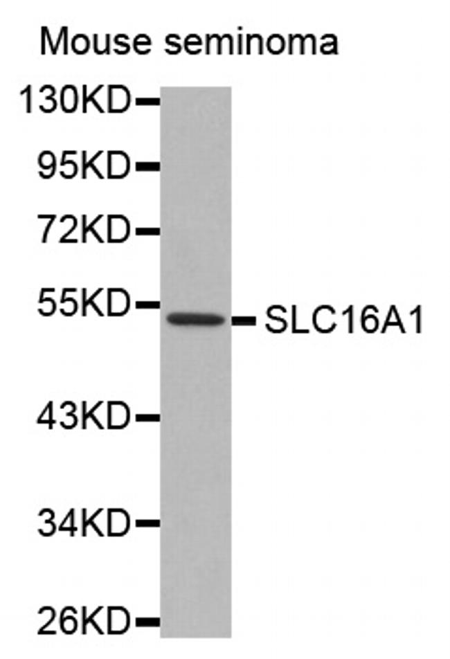 MCT1 Antibody in Western Blot (WB)