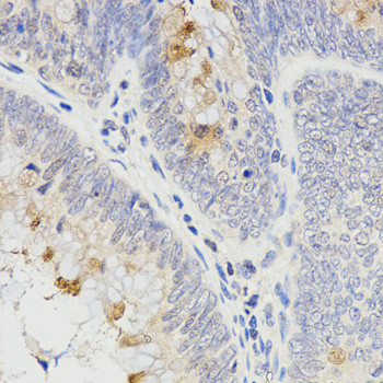 RAMP2 Antibody in Immunohistochemistry (Paraffin) (IHC (P))